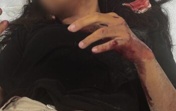 Wanita Alami Luka Parah Diduga Korban Penjambretan di Jalan Seroja, Timika