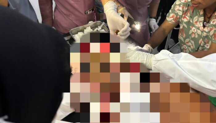 Warga Sipil Jadi Korban Kekerasan KKB di Yahukimo, Satu Orang Luka Serius