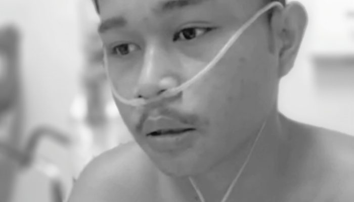 Geng Begal Biadab Tebas Tangan Pemuda Hingga Putus di Bougenville