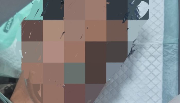 Pemuda Ditikam Kelompok OTK di Perempatan SP 1-SP 4