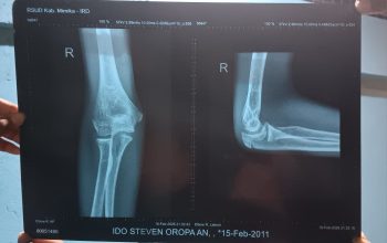 Sengkarut Kekerasan di SMPN 5 Mimika: Antara Disiplin Guru dan Amarah Orang Tua