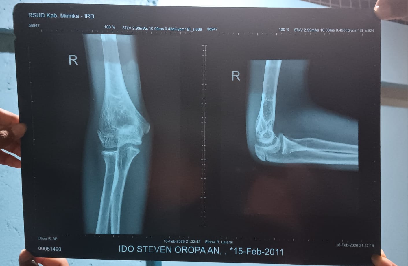 Sengkarut Kekerasan di SMPN 5 Mimika: Antara Disiplin Guru dan Amarah Orang Tua