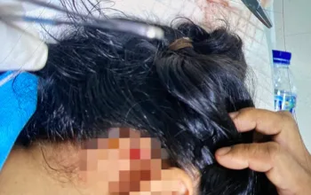 Bidan Puskesmas Mapurjaya Terluka Usai Ambulans Dilempari Batu, Pelaku Diduga Kelompok Mabuk di Jalan Poros Timika