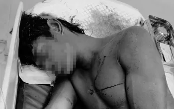 Pria di Timika Diduga Jadi Korban Penganiayaan, Polisi Masih Selidiki Pelaku