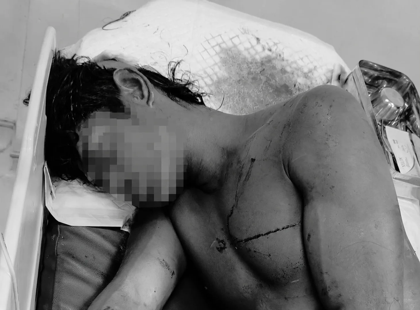 Pria di Timika Diduga Jadi Korban Penganiayaan, Polisi Masih Selidiki Pelaku